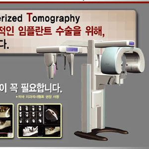 치과전용 CT 도입 진료